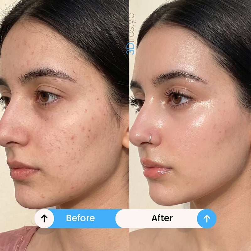 Brightening & Dark Spots