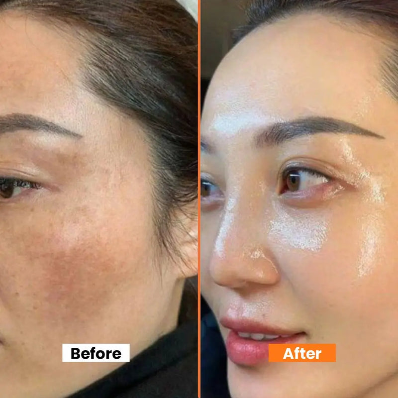 Brightening & Dark Spots